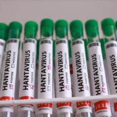 Hantavirus: en Salta se registraron 17 casos