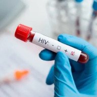 Realizan test gratuitos de VIH y Sífilis en la plazoleta IV siglos