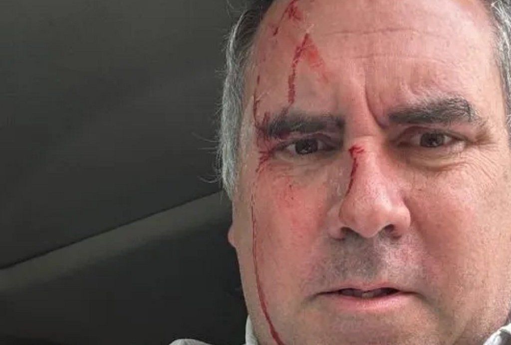 Perú: balearon al candidato  Belaunde Llosa