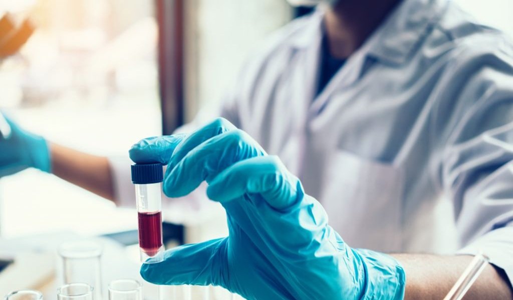 Vigilancia epidemiológica por casos de meningitis en la provincia