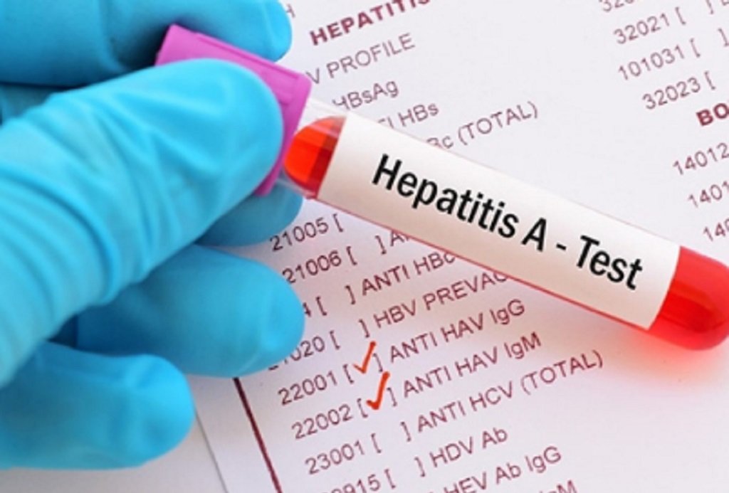 En Salta ya suman 10 casos de Hepatitis A 