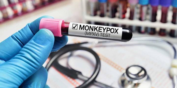 La OMS declaró el fin de la pandemia por la viruela del mono
